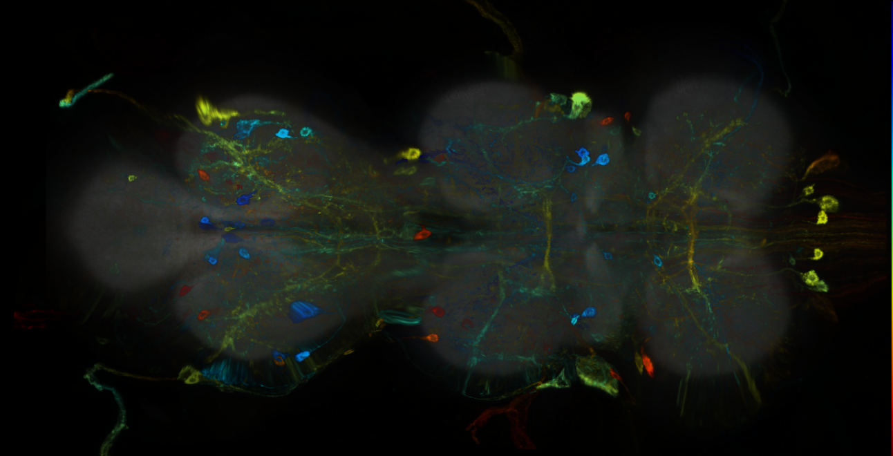 P{GMR38H03-GAL4} expression pattern