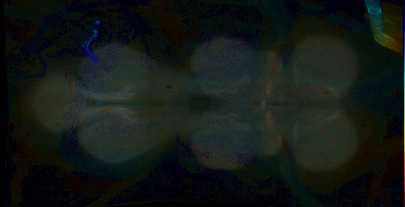 P{GMR39E11-GAL4} expression pattern