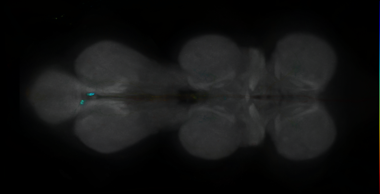 P{GMR39G01-GAL4} expression pattern