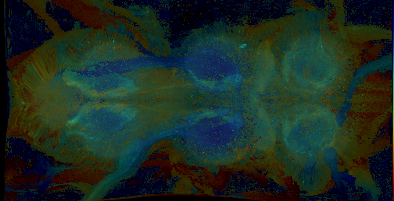 P{GMR40A11-GAL4} expression pattern