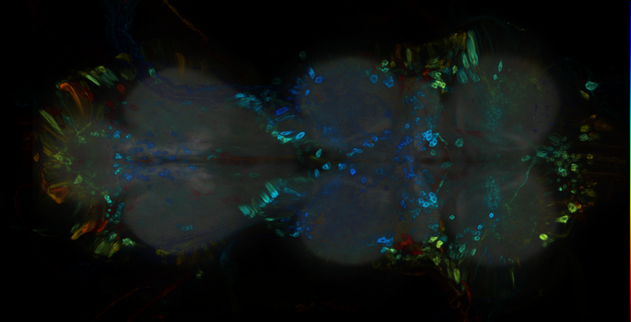 P{GMR40D12-GAL4} expression pattern