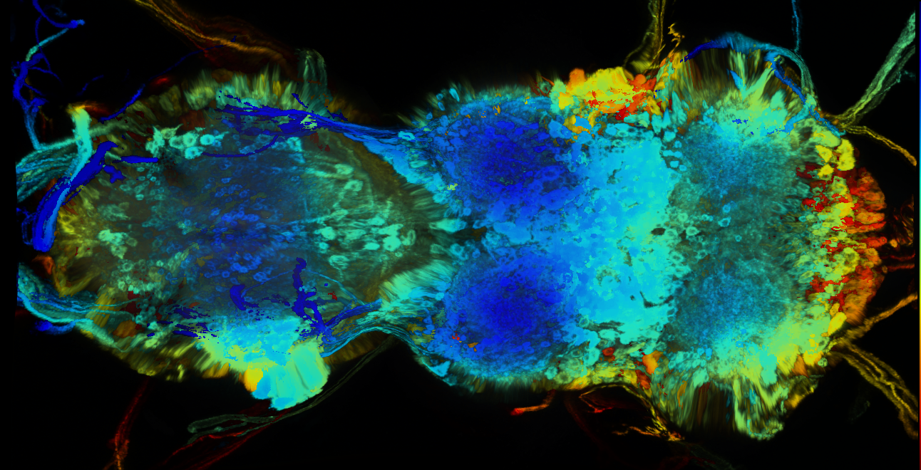 P{GMR40E01-GAL4} expression pattern