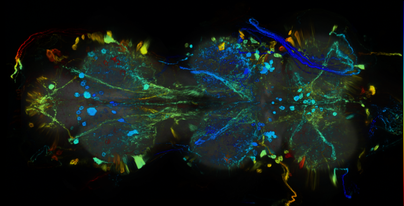 P{GMR40E10-GAL4} expression pattern
