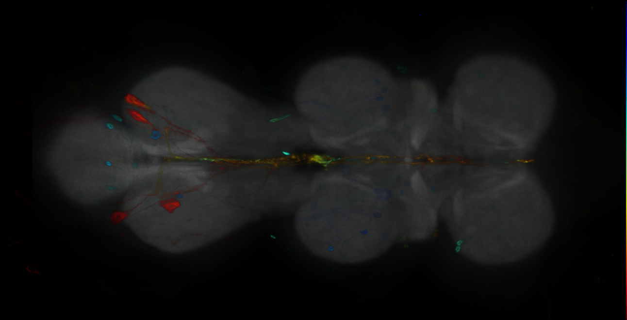 P{GMR40H02-GAL4} expression pattern