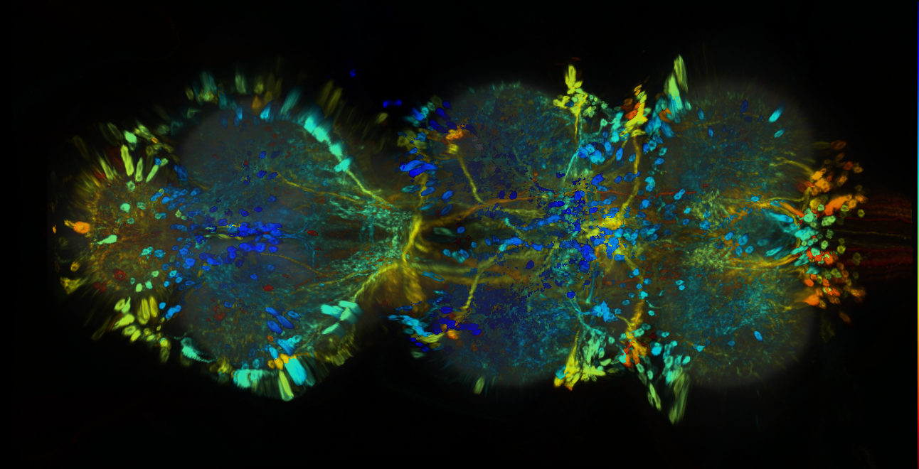 P{GMR42D11-GAL4} expression pattern