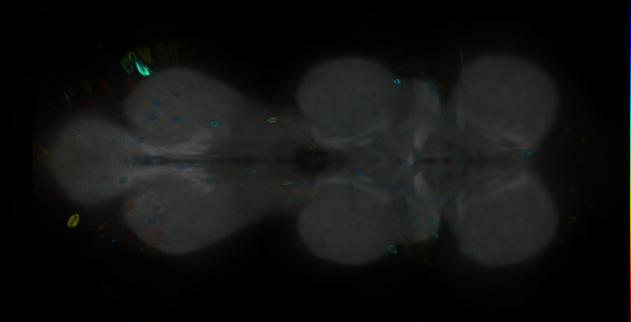 P{GMR43A06-GAL4} expression pattern