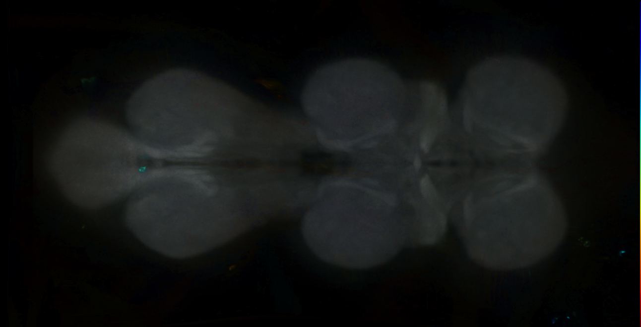 P{GMR43H06-GAL4} expression pattern