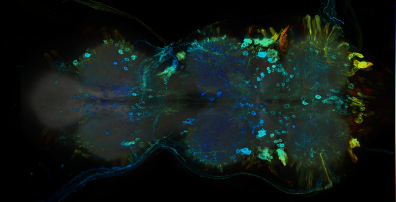 P{GMR44C06-GAL4} expression pattern
