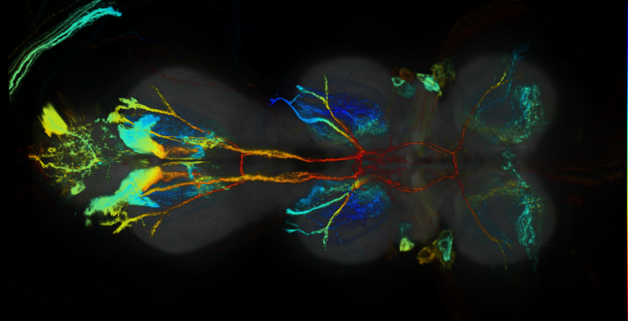 P{GMR44D07-GAL4} expression pattern