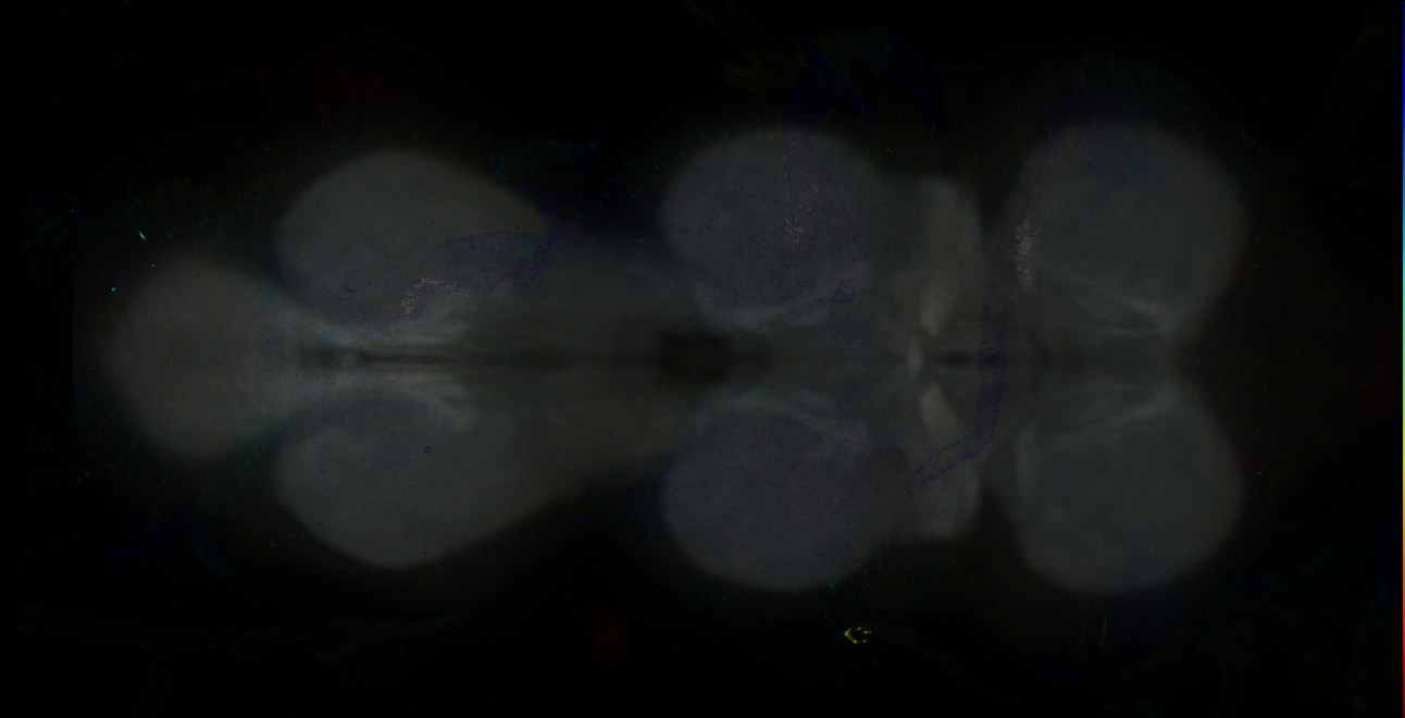 P{GMR44F03-GAL4} expression pattern