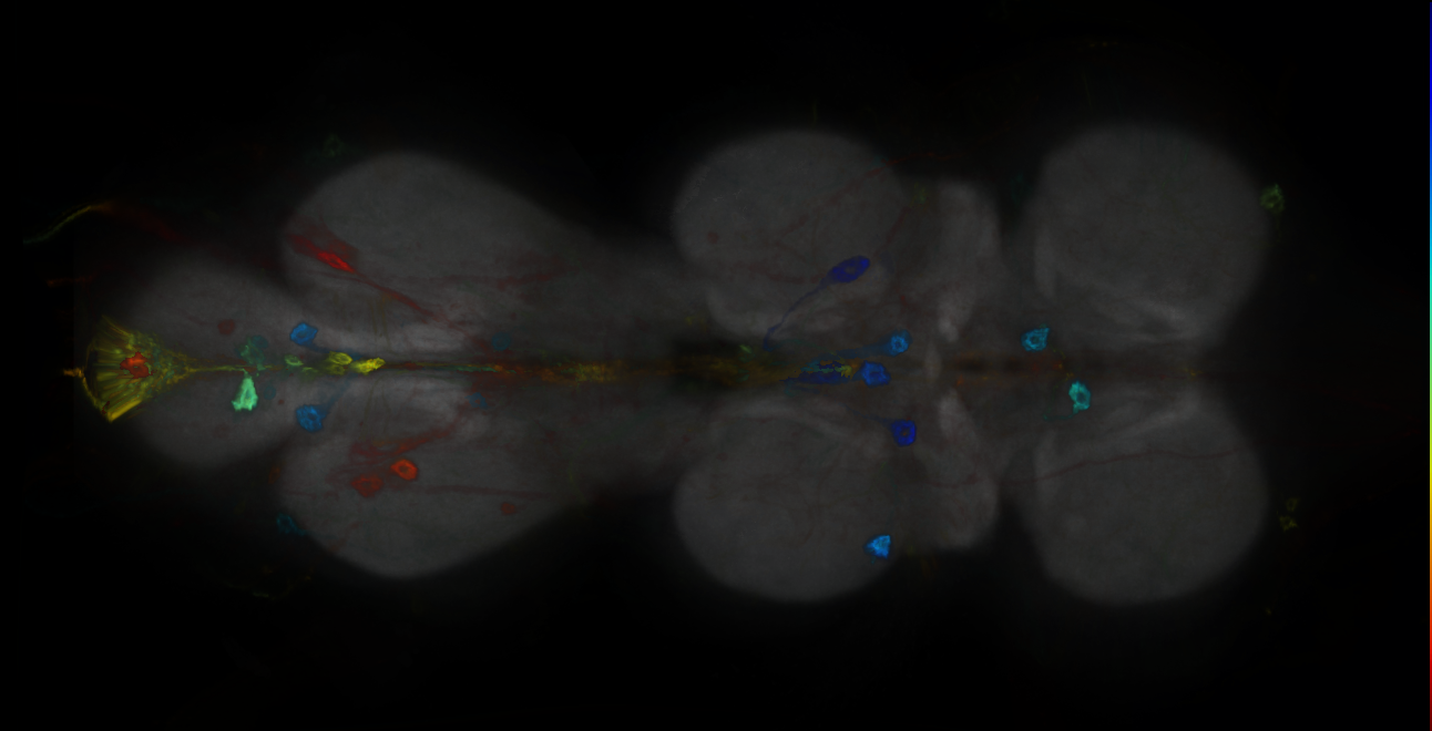 P{GMR44H01-GAL4} expression pattern