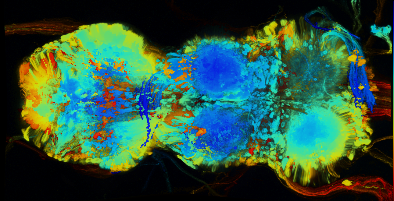 P{GMR44H12-GAL4} expression pattern