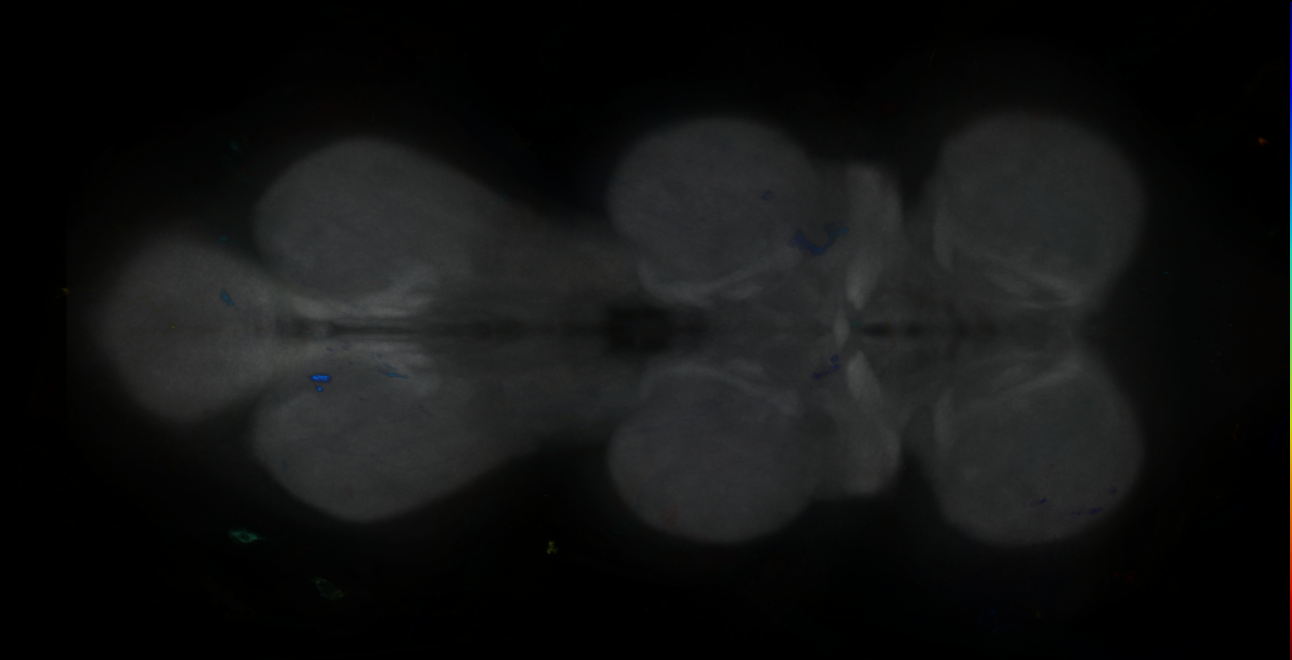 P{GMR45A11-GAL4} expression pattern