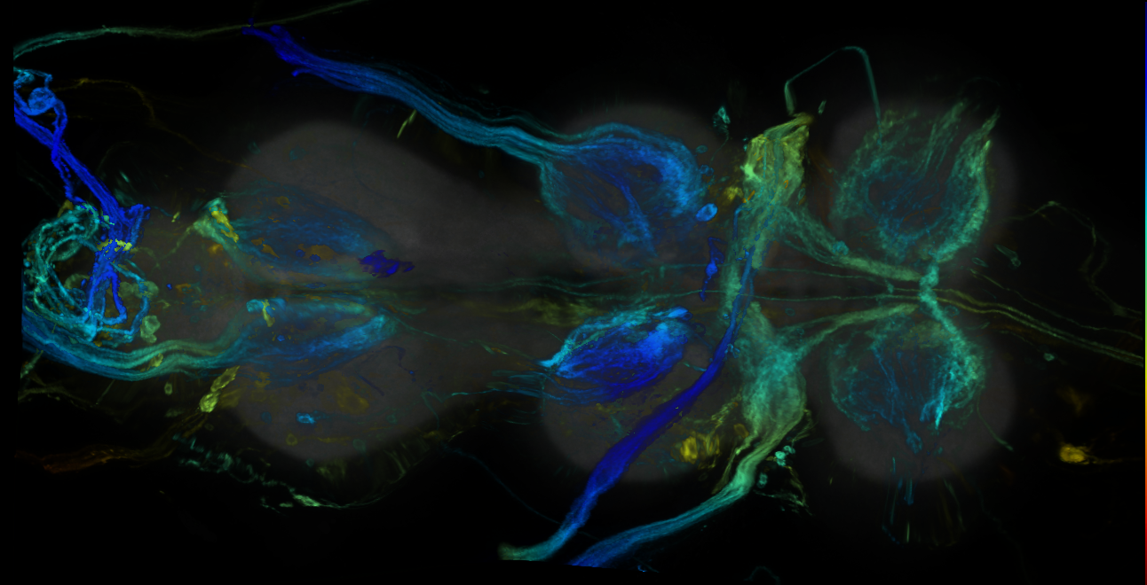 P{GMR45C01-GAL4} expression pattern