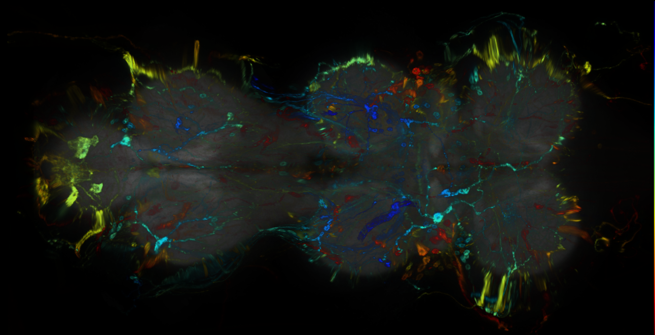 P{GMR45G04-GAL4} expression pattern