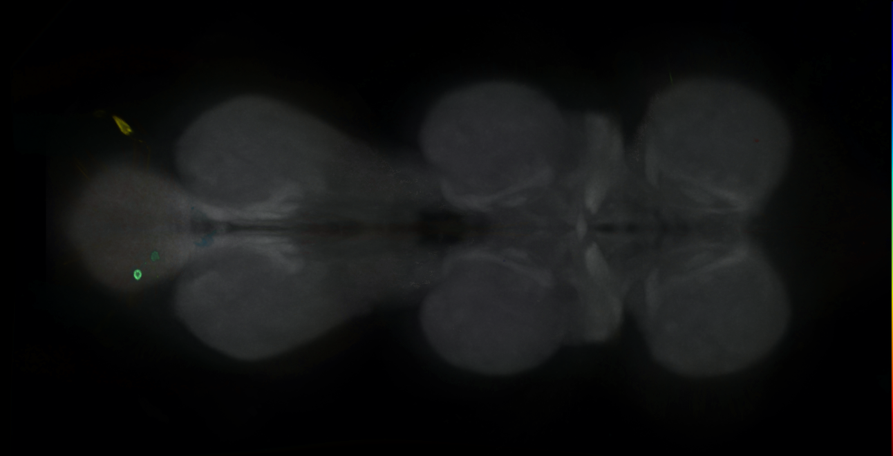 P{GMR45G10-GAL4} expression pattern