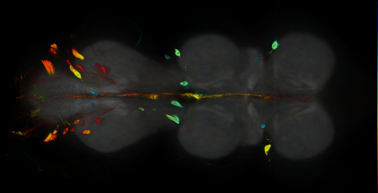P{GMR47A08-GAL4} expression pattern