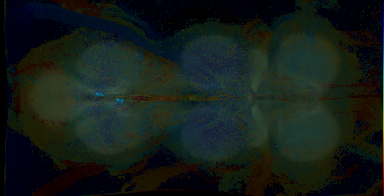 P{GMR47C02-GAL4} expression pattern