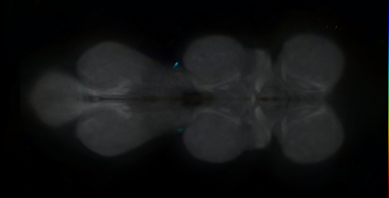 P{GMR47E05-GAL4} expression pattern