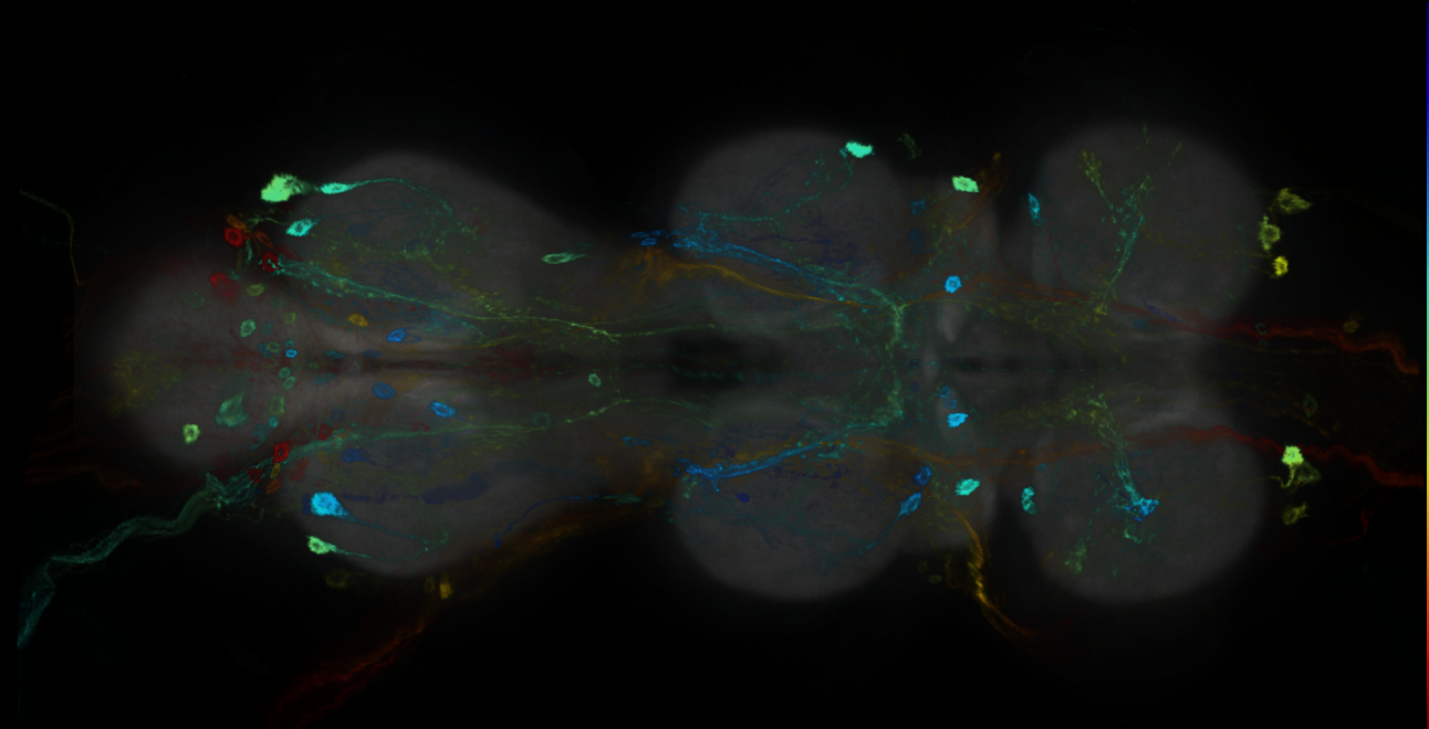 P{GMR49C03-GAL4} expression pattern