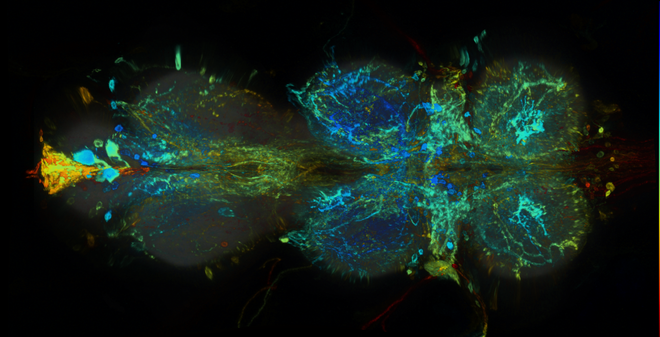 P{GMR49D10-GAL4} expression pattern