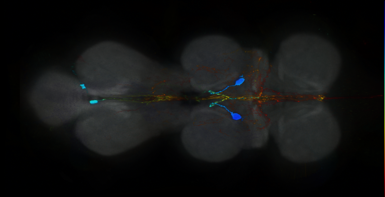 P{GMR49E10-GAL4} expression pattern
