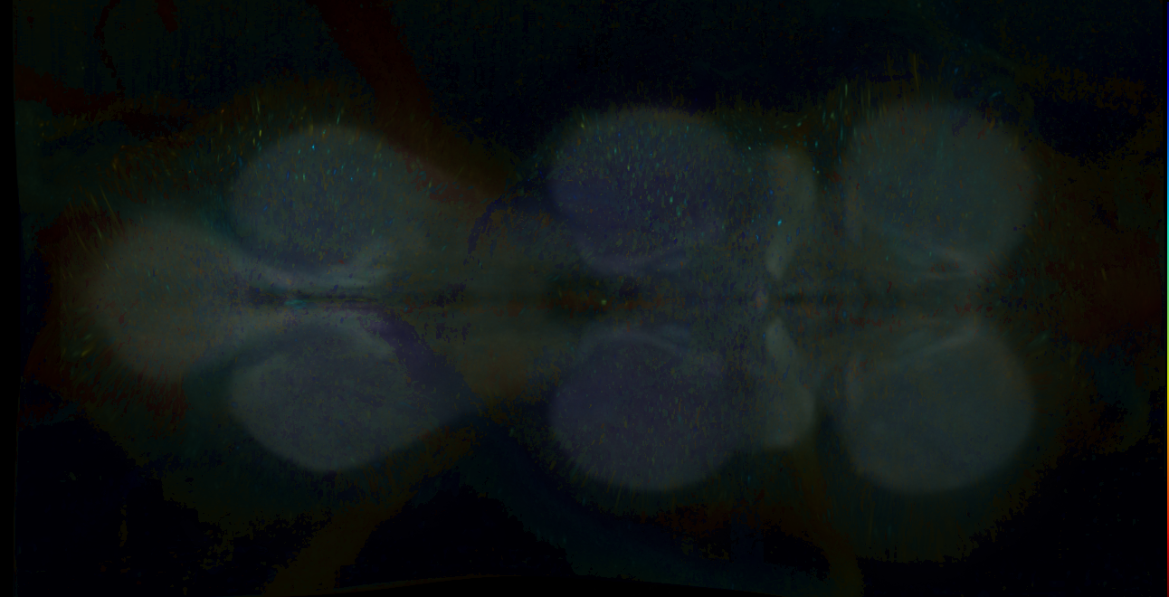 P{GMR49H04-GAL4} expression pattern