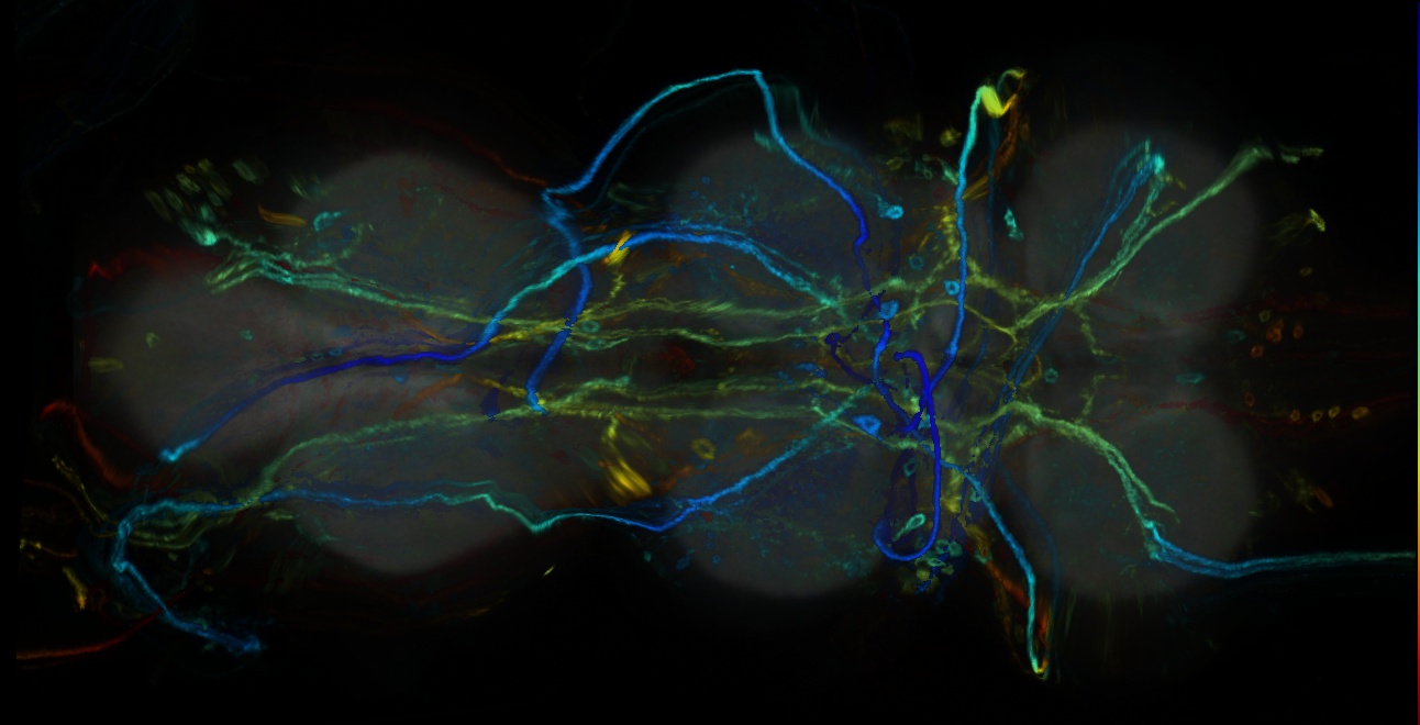 P{GMR49H06-GAL4} expression pattern