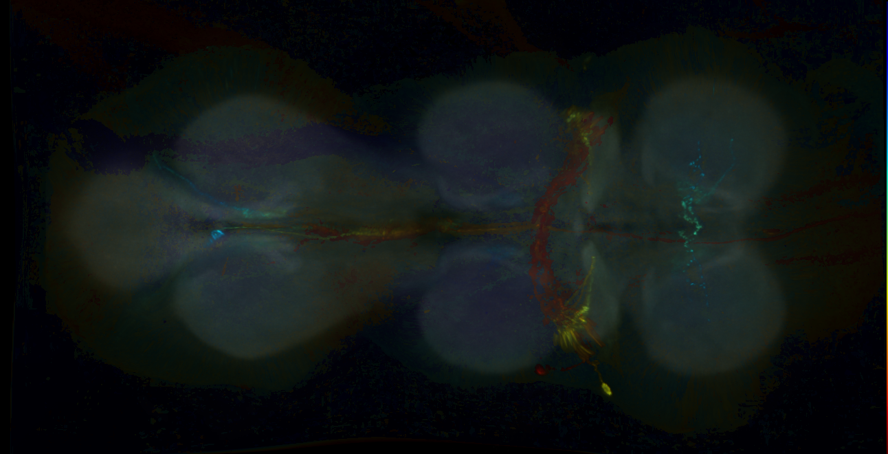 P{GMR51A03-GAL4} expression pattern