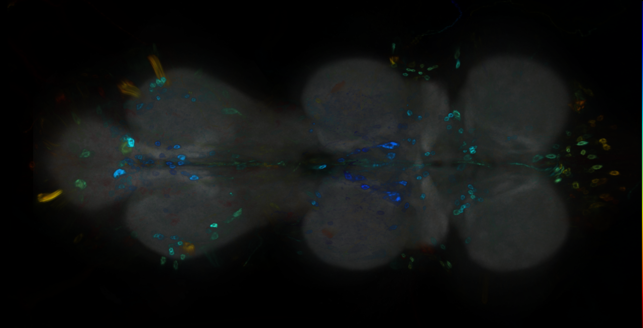 P{GMR51E03-GAL4} expression pattern