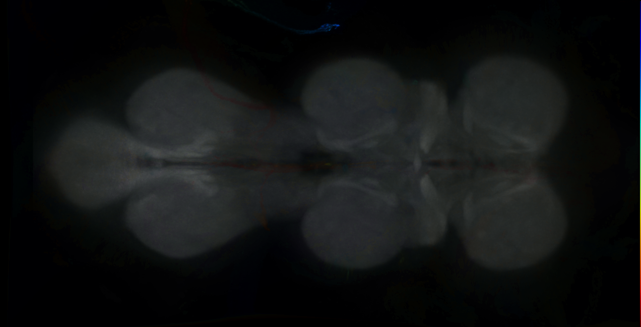 P{GMR52F01-GAL4} expression pattern