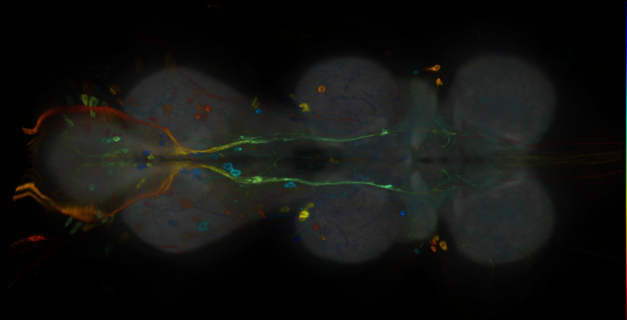 P{GMR53A02-GAL4} expression pattern