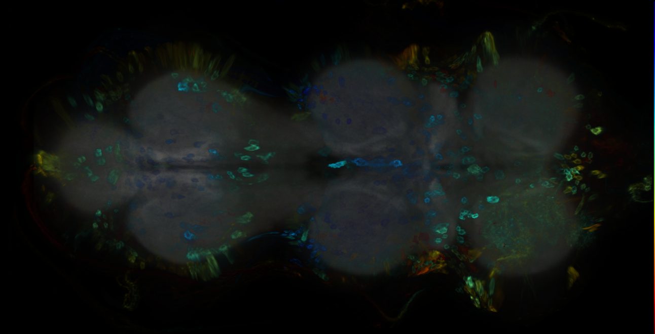 P{GMR53F01-GAL4} expression pattern