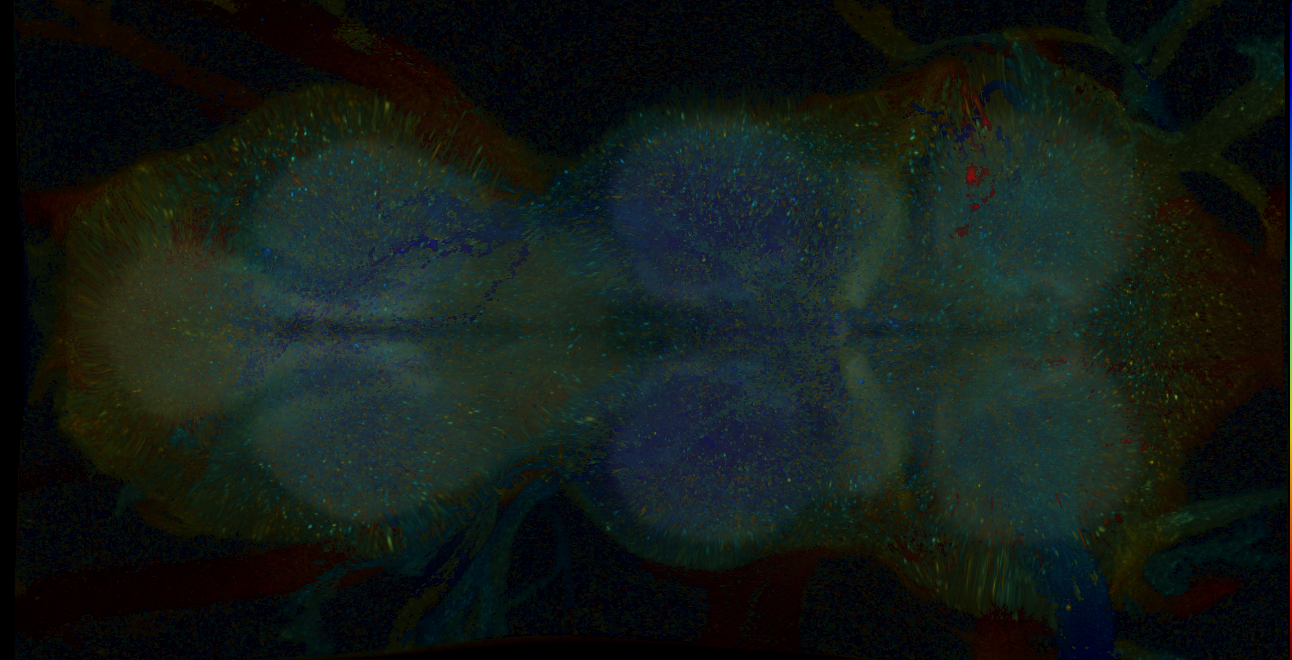 P{GMR54B04-GAL4} expression pattern
