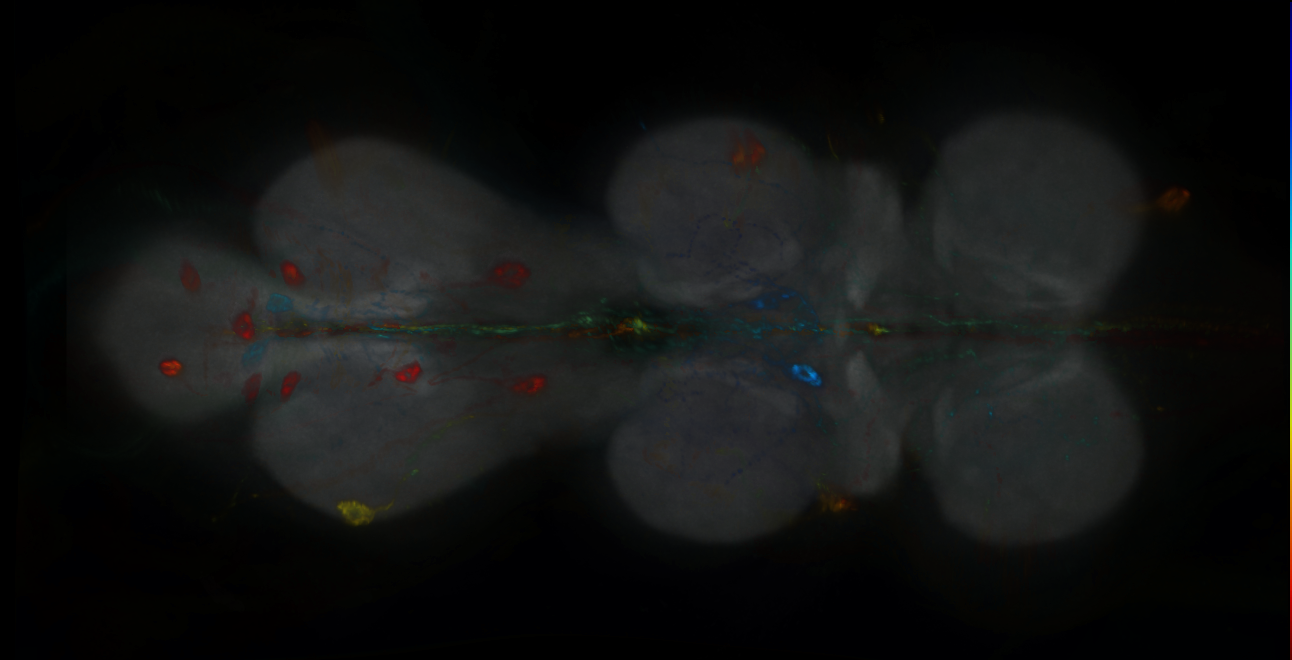 P{GMR54B10-GAL4} expression pattern