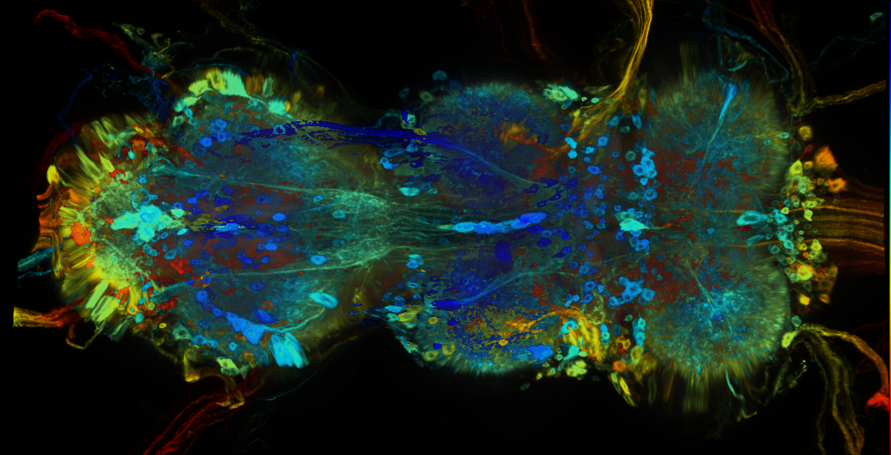 P{GMR54E04-GAL4} expression pattern