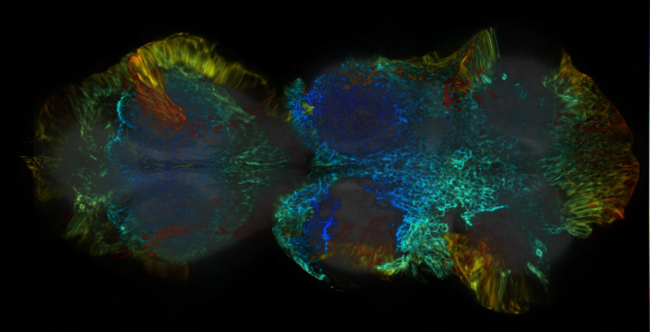 P{GMR54H02-GAL4} expression pattern