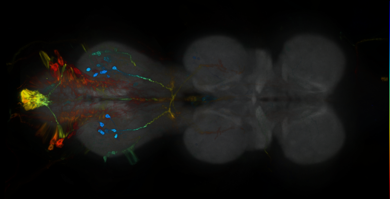 P{GMR54H11-GAL4} expression pattern