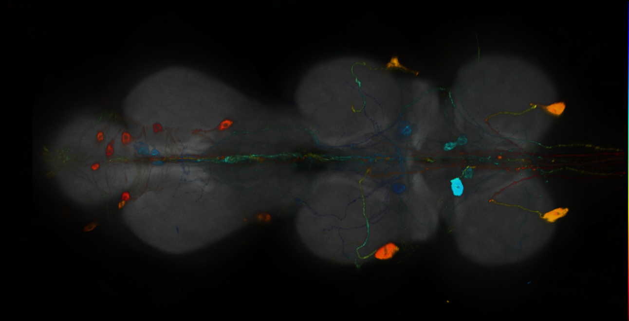 P{GMR55A10-GAL4} expression pattern