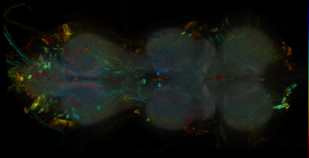 P{GMR55C04-GAL4} expression pattern