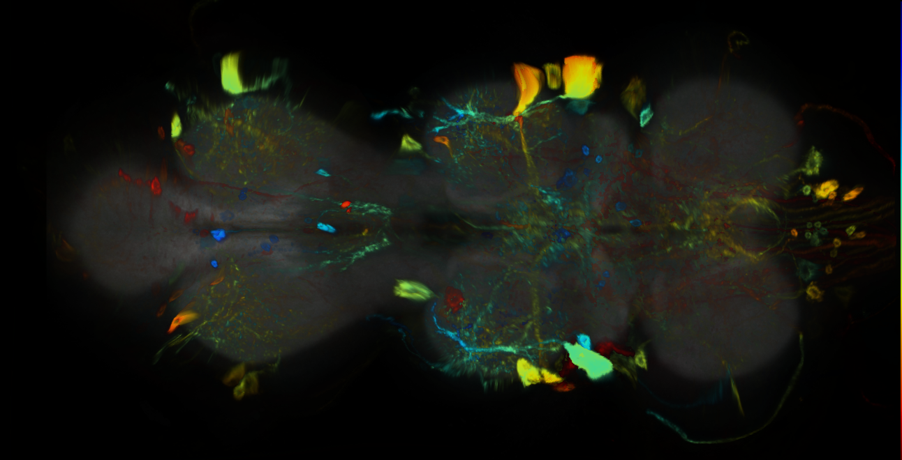 P{GMR55E02-GAL4} expression pattern