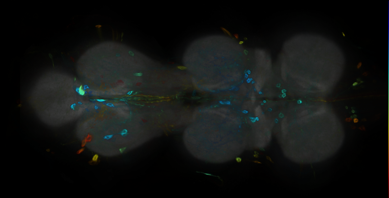 P{GMR55F11-GAL4} expression pattern