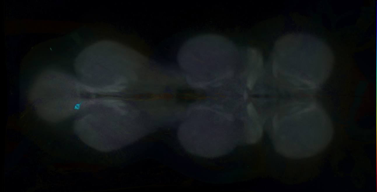 P{GMR56A03-GAL4} expression pattern