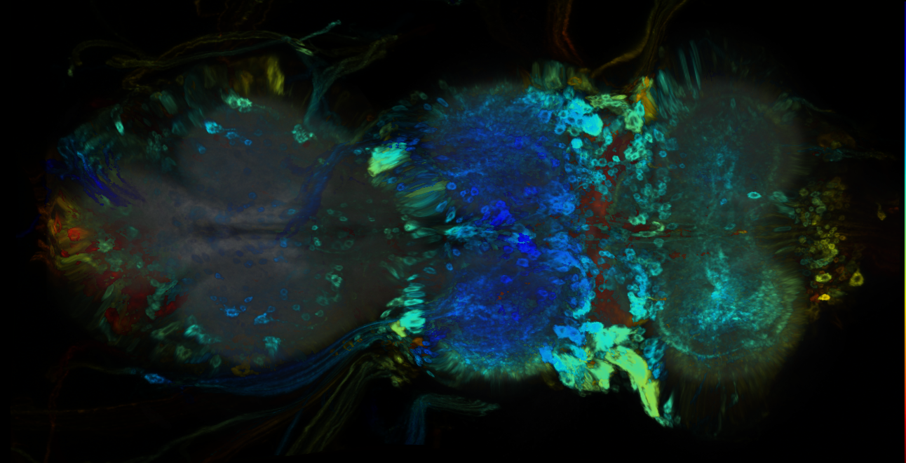 P{GMR60H11-GAL4} expression pattern