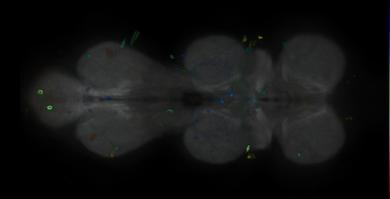 P{GMR64A06-GAL4} expression pattern