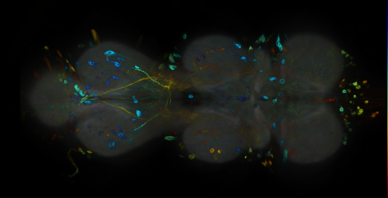 P{GMR64B02-GAL4} expression pattern