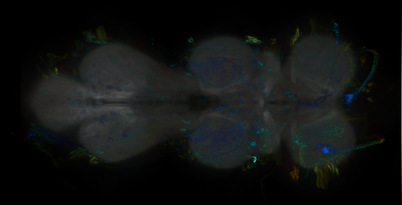 P{GMR64F11-GAL4} expression pattern
