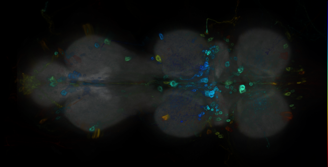P{GMR65A09-GAL4} expression pattern