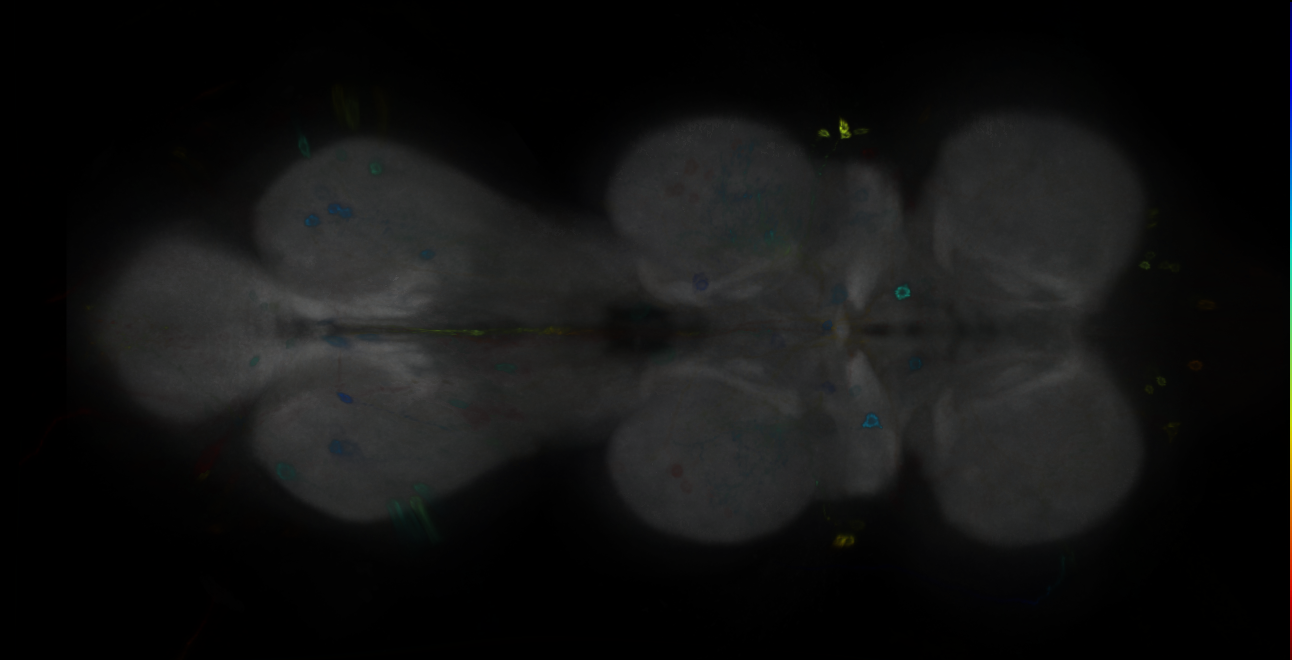 P{GMR65A12-GAL4} expression pattern