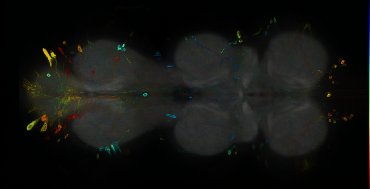 P{GMR65B08-GAL4} expression pattern